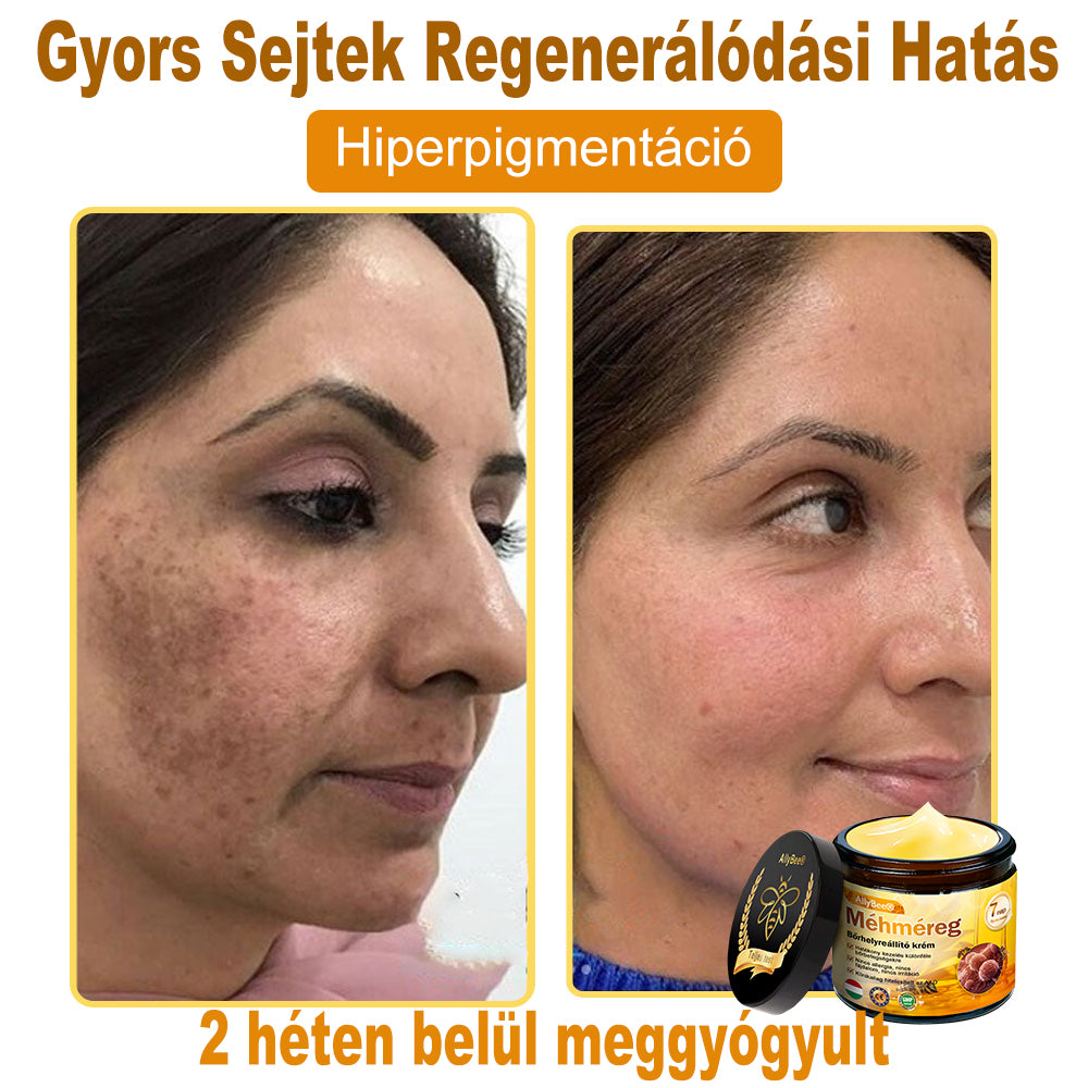 🌿HOUKEA® Méhméreg Bőr Helyreállító Krém 🔥 Bőrgyógyász ajánlása - Amerikai fejlesztés, magyarországi gyártás és szállítás