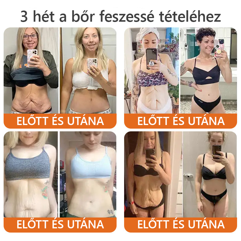 Csak 5 üveg! Éljen az exkluzív 40%-os kedvezménnyel most! Tartsa bőrét fiatalosnak és ragyogónak mindössze 1-4 hét alatt. Ne hagyd ki a lehetőséget - ez az ajánlat csak jövőre jön újra. Cselekedjen gyorsan! 180 napos pénzvisszafizetési garancia!!