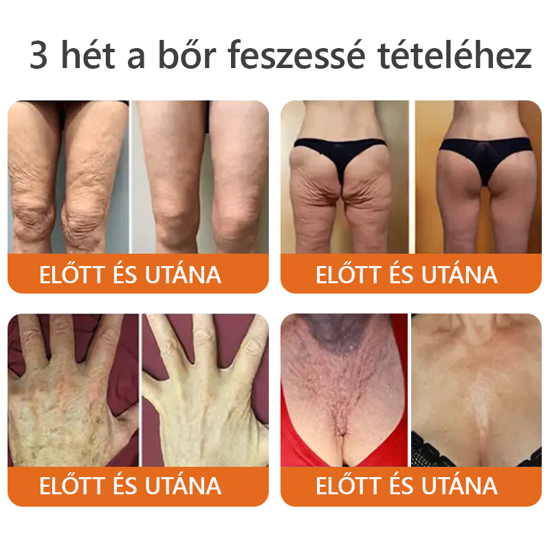 🌿HOUKEA® Méhméreg Bőr Helyreállító Krém 🔥 Bőrgyógyász ajánlása - Amerikai fejlesztés, magyarországi gyártás és szállítás