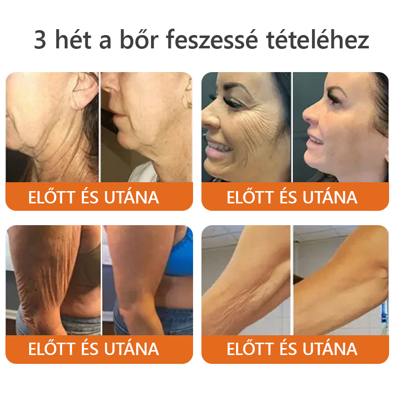 🌿HOUKEA® Méhméreg Bőr Helyreállító Krém 🔥 Bőrgyógyász ajánlása - Amerikai fejlesztés, magyarországi gyártás és szállítás