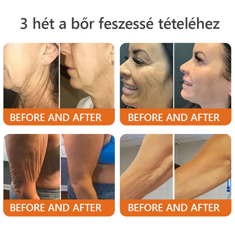 Csak 5 üveg! Éljen az exkluzív 40%-os kedvezménnyel most! Tartsa bőrét fiatalosnak és ragyogónak mindössze 1-4 hét alatt. Ne hagyd ki a lehetőséget - ez az ajánlat csak jövőre jön újra. Cselekedjen gyorsan! 180 napos pénzvisszafizetési garancia!!