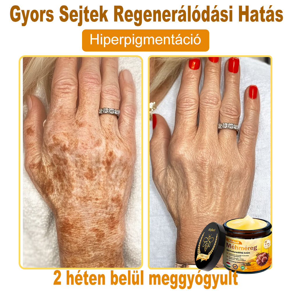 🌿HOUKEA® Méhméreg Bőr Helyreállító Krém 🔥 Bőrgyógyász ajánlása - Amerikai fejlesztés, magyarországi gyártás és szállítás