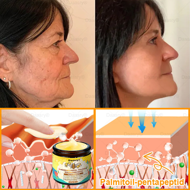 HOUKEA® Méhméreg Kezelő Krém, méhméreg peptidekkel, botulinum toxinnal, hialuronsavval és kollagénnel💧. Hatékonyan küzd a ráncok, finom vonalak, megereszkedés, terhességi csíkok és sötét foltok ellen — feszesítés, emelés és kiemelkedő eredmények!