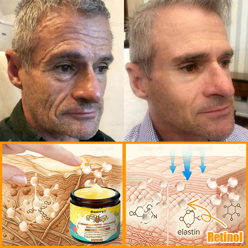 HOUKEA® Méhméreg Kezelő Krém, méhméreg peptidekkel, botulinum toxinnal, hialuronsavval és kollagénnel💧. Hatékonyan küzd a ráncok, finom vonalak, megereszkedés, terhességi csíkok és sötét foltok ellen — feszesítés, emelés és kiemelkedő eredmények!