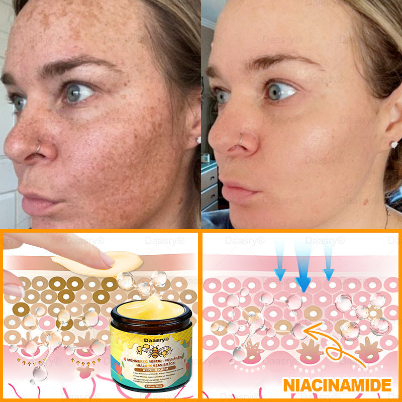 HOUKEA® Méhméreg Kezelő Krém, méhméreg peptidekkel, botulinum toxinnal, hialuronsavval és kollagénnel💧. Hatékonyan küzd a ráncok, finom vonalak, megereszkedés, terhességi csíkok és sötét foltok ellen — feszesítés, emelés és kiemelkedő eredmények!