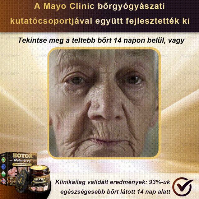 Csak 5 üveg! Éljen az exkluzív 40%-os kedvezménnyel most! Tartsa bőrét fiatalosnak és ragyogónak mindössze 1-4 hét alatt. Ne hagyd ki a lehetőséget - ez az ajánlat csak jövőre jön újra. Cselekedjen gyorsan! 180 napos pénzvisszafizetési garancia!!