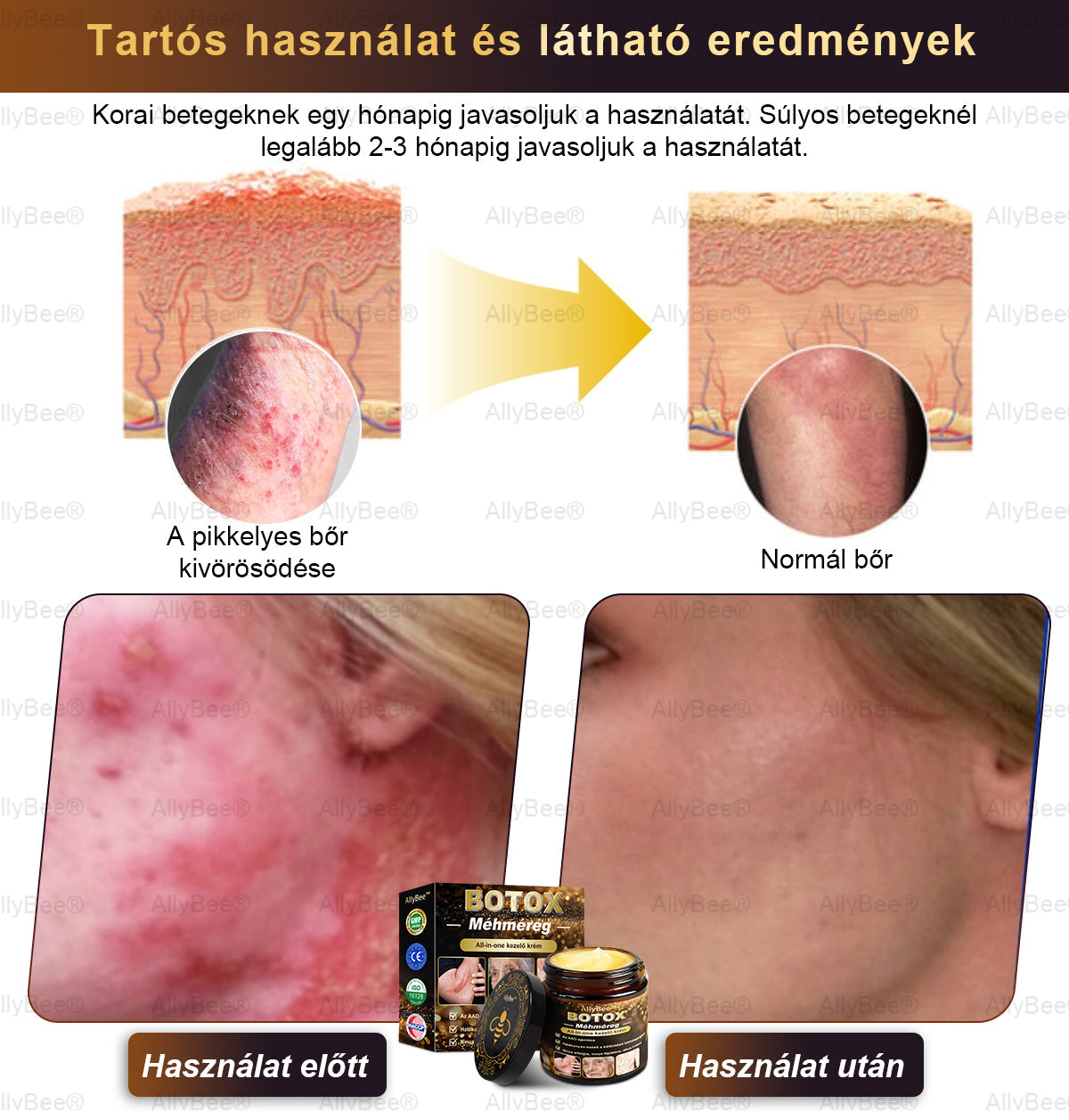 Csak 5 üveg! Éljen az exkluzív 40%-os kedvezménnyel most! Tartsa bőrét fiatalosnak és ragyogónak mindössze 1-4 hét alatt. Ne hagyd ki a lehetőséget - ez az ajánlat csak jövőre jön újra. Cselekedjen gyorsan! 180 napos pénzvisszafizetési garancia!!