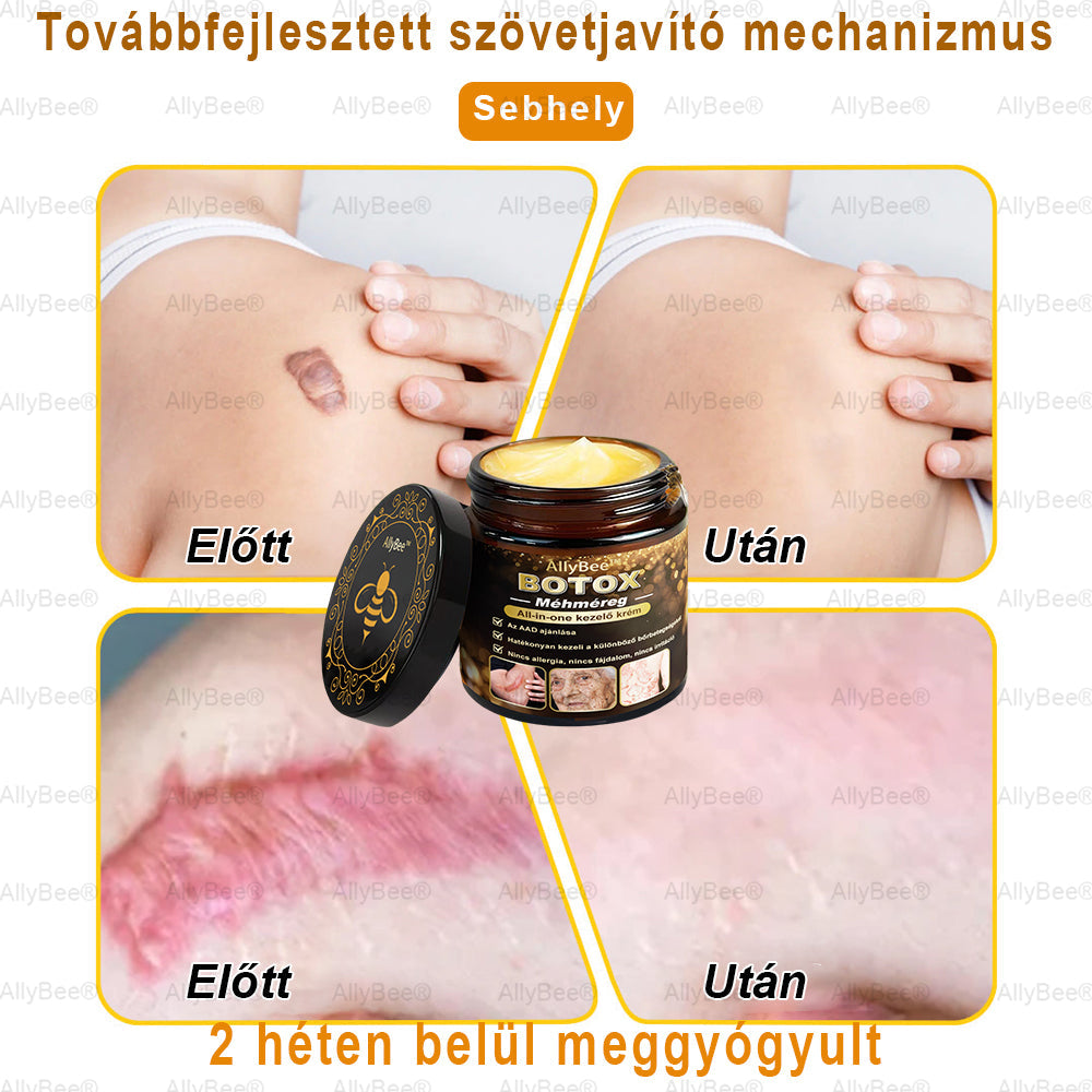 Csak 5 üveg! Éljen az exkluzív 40%-os kedvezménnyel most! Tartsa bőrét fiatalosnak és ragyogónak mindössze 1-4 hét alatt. Ne hagyd ki a lehetőséget - ez az ajánlat csak jövőre jön újra. Cselekedjen gyorsan! 180 napos pénzvisszafizetési garancia!!