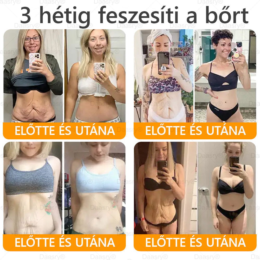 HOUKEA® Méhméreg Kezelő Krém, méhméreg peptidekkel, botulinum toxinnal, hialuronsavval és kollagénnel💧. Hatékonyan küzd a ráncok, finom vonalak, megereszkedés, terhességi csíkok és sötét foltok ellen — feszesítés, emelés és kiemelkedő eredmények!