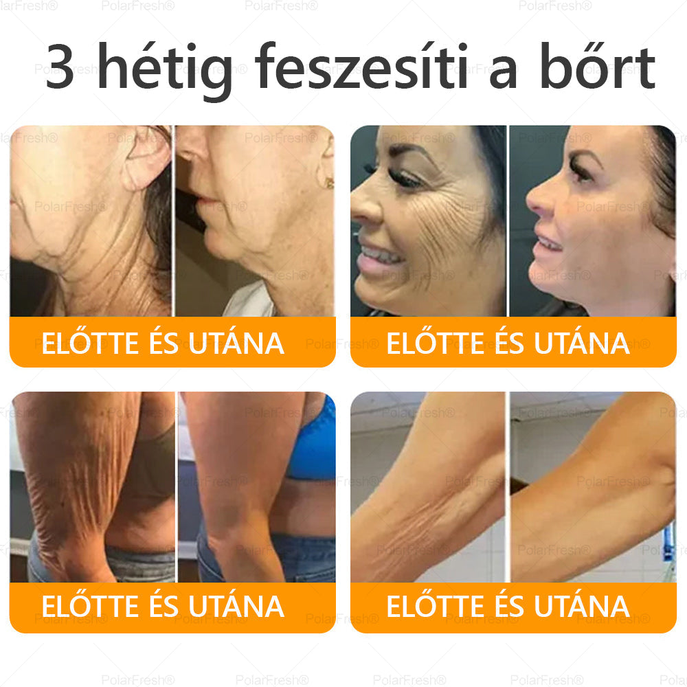 HOUKEA® Méhméreg Kezelő Krém, méhméreg peptidekkel, botulinum toxinnal, hialuronsavval és kollagénnel💧. Hatékonyan küzd a ráncok, finom vonalak, megereszkedés, terhességi csíkok és sötét foltok ellen — feszesítés, emelés és kiemelkedő eredmények!