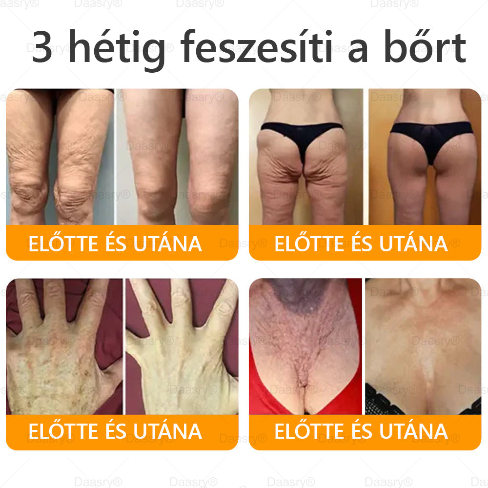 HOUKEA® Méhméreg Kezelő Krém, méhméreg peptidekkel, botulinum toxinnal, hialuronsavval és kollagénnel💧. Hatékonyan küzd a ráncok, finom vonalak, megereszkedés, terhességi csíkok és sötét foltok ellen — feszesítés, emelés és kiemelkedő eredmények!