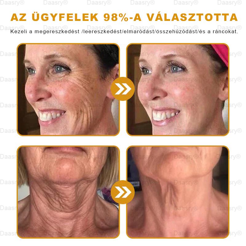 Bőrgyógyász ajánlása ✨ Daasry® Méhméreg Bőr Helyreállító Krém 🔥 Amerikai fejlesztés, magyarországi gyártás és szállítás