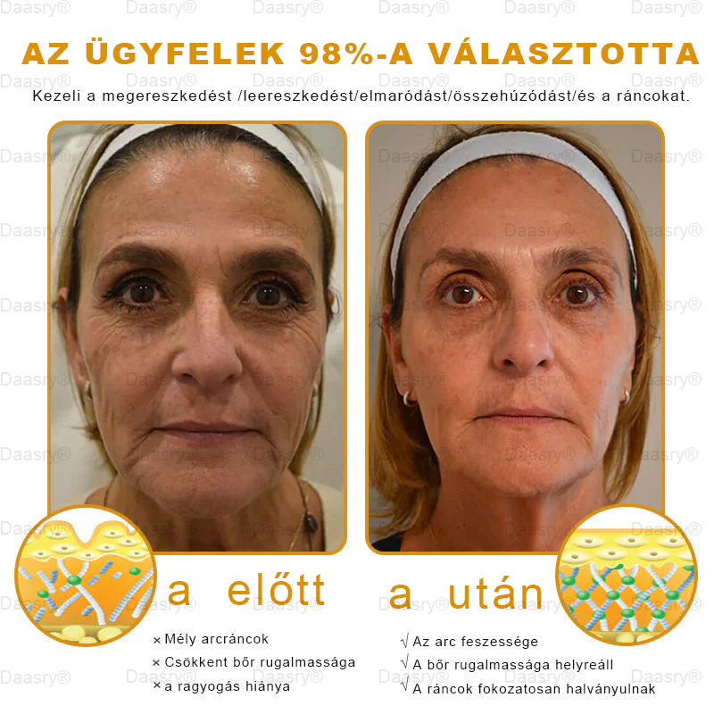 Bőrgyógyász ajánlása ✨ Daasry® Méhméreg Bőr Helyreállító Krém 🔥 Amerikai fejlesztés, magyarországi gyártás és szállítás