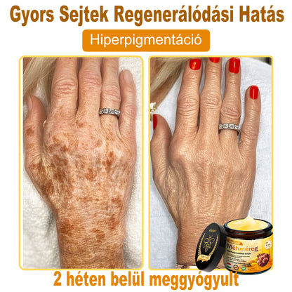 Bőrgyógyász ajánlása ✨ HOUKEA® Méhméreg Bőr Helyreállító Krém 🔥 Amerikai fejlesztés, magyarországi gyártás és szállítás
