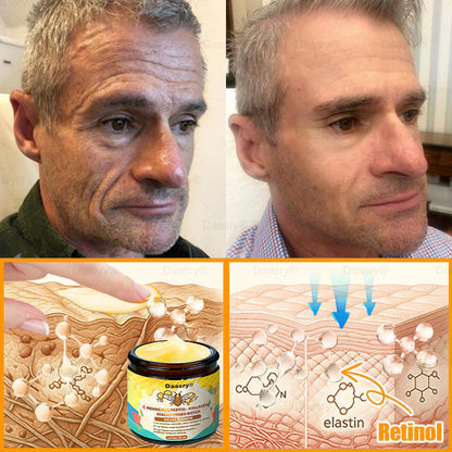 HOUKEA® Méhméreg Kezelő Krém, méhméreg peptidekkel, botulinum toxinnal, hialuronsavval és kollagénnel💧. Hatékonyan küzd a ráncok, finom vonalak, megereszkedés, terhességi csíkok és sötét foltok ellen — feszesítés, emelés és kiemelkedő eredmények!