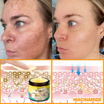HOUKEA® Méhméreg Kezelő Krém, méhméreg peptidekkel, botulinum toxinnal, hialuronsavval és kollagénnel💧. Hatékonyan küzd a ráncok, finom vonalak, megereszkedés, terhességi csíkok és sötét foltok ellen — feszesítés, emelés és kiemelkedő eredmények!