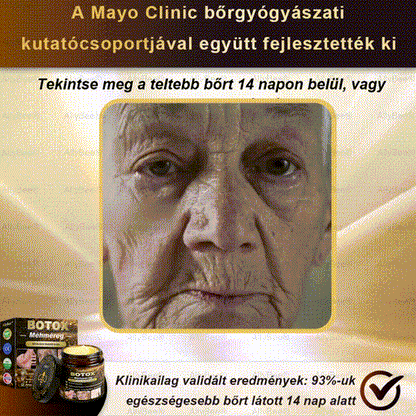 Csak 5 üveg! Éljen az exkluzív 40%-os kedvezménnyel most! Tartsa bőrét fiatalosnak és ragyogónak mindössze 1-4 hét alatt. Ne hagyd ki a lehetőséget - ez az ajánlat csak jövőre jön újra. Cselekedjen gyorsan! 180 napos pénzvisszafizetési garancia!！