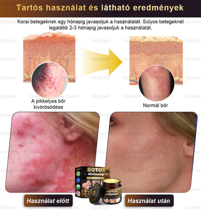 Csak 5 üveg! Éljen az exkluzív 40%-os kedvezménnyel most! Tartsa bőrét fiatalosnak és ragyogónak mindössze 1-4 hét alatt. Ne hagyd ki a lehetőséget - ez az ajánlat csak jövőre jön újra. Cselekedjen gyorsan! 180 napos pénzvisszafizetési garancia!！