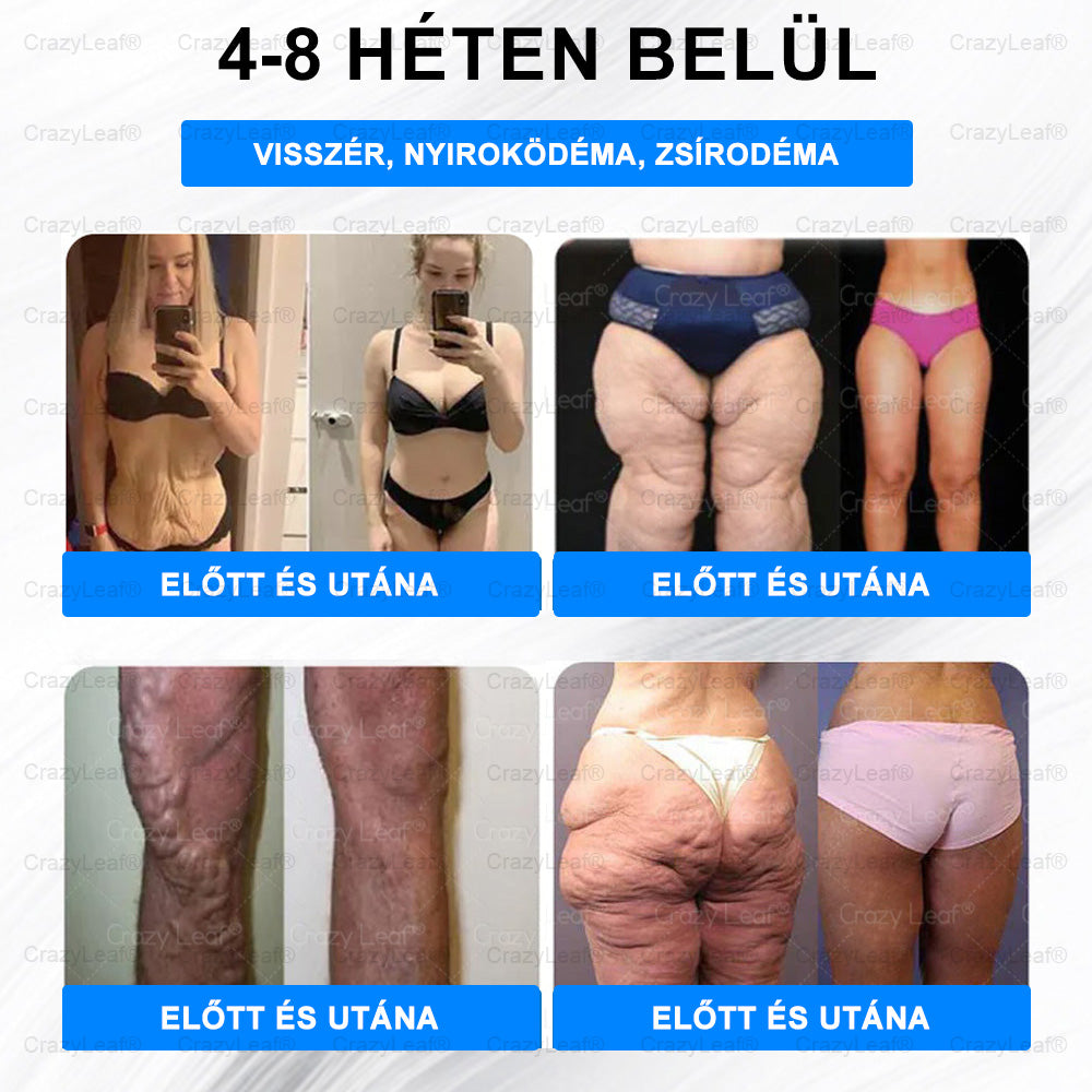 A Pécsi Tudományegyetem ajánlásával – Vezető GLP-1 tapasz Magyarországon HOUKEA® Nano Mikrotűs Tapasz SMGT-GLP-1 + Kollagén + Matrixyl 3000 Zsírégetés • Bőrfeszesítés • Vércukor-egyensúly • 7 nap alatt látható eredmény • Injekció nélkül