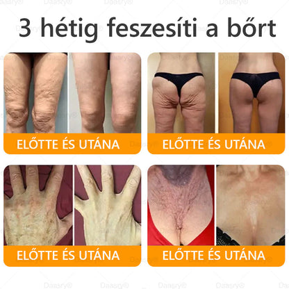 HOUKEA® Méhméreg Kezelő Krém, méhméreg peptidekkel, botulinum toxinnal, hialuronsavval és kollagénnel💧. Hatékonyan küzd a ráncok, finom vonalak, megereszkedés, terhességi csíkok és sötét foltok ellen — feszesítés, emelés és kiemelkedő eredmények!